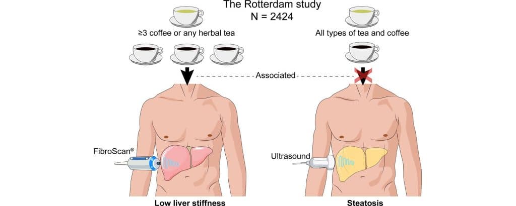 Does Coffee Affect Your Liver?