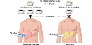 does coffee affect your liver 3