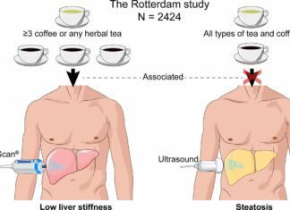 does coffee affect your liver 3